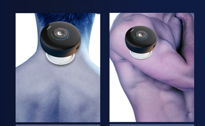 Cupping Therapy Mini Massager